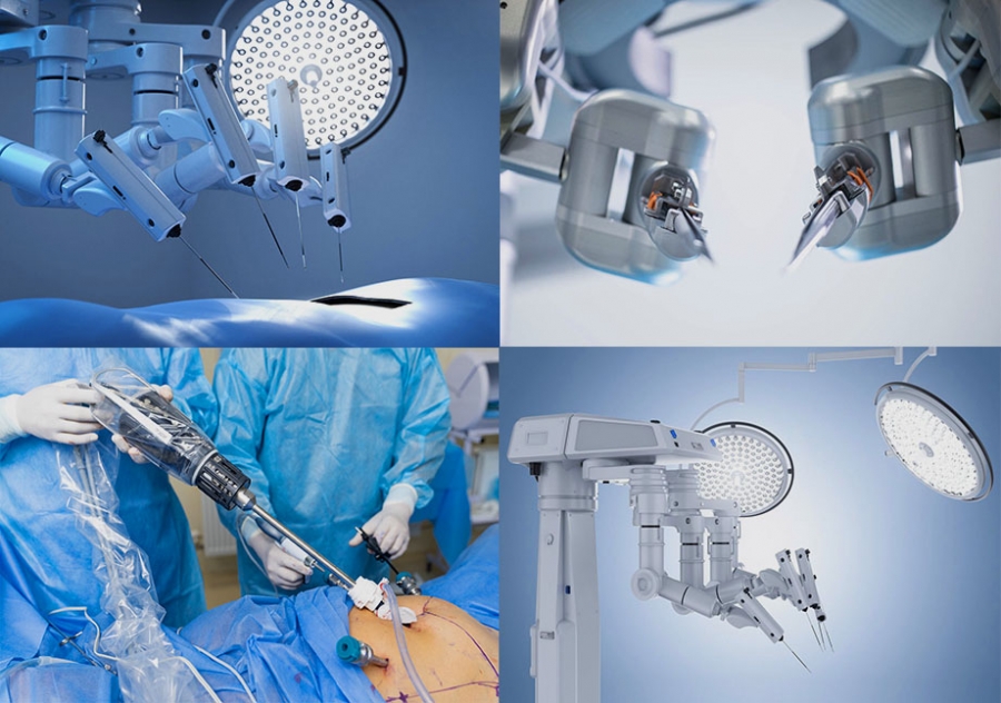 Роботизована хірургія: Чи увірветься ШІ в пластичну хірургію?